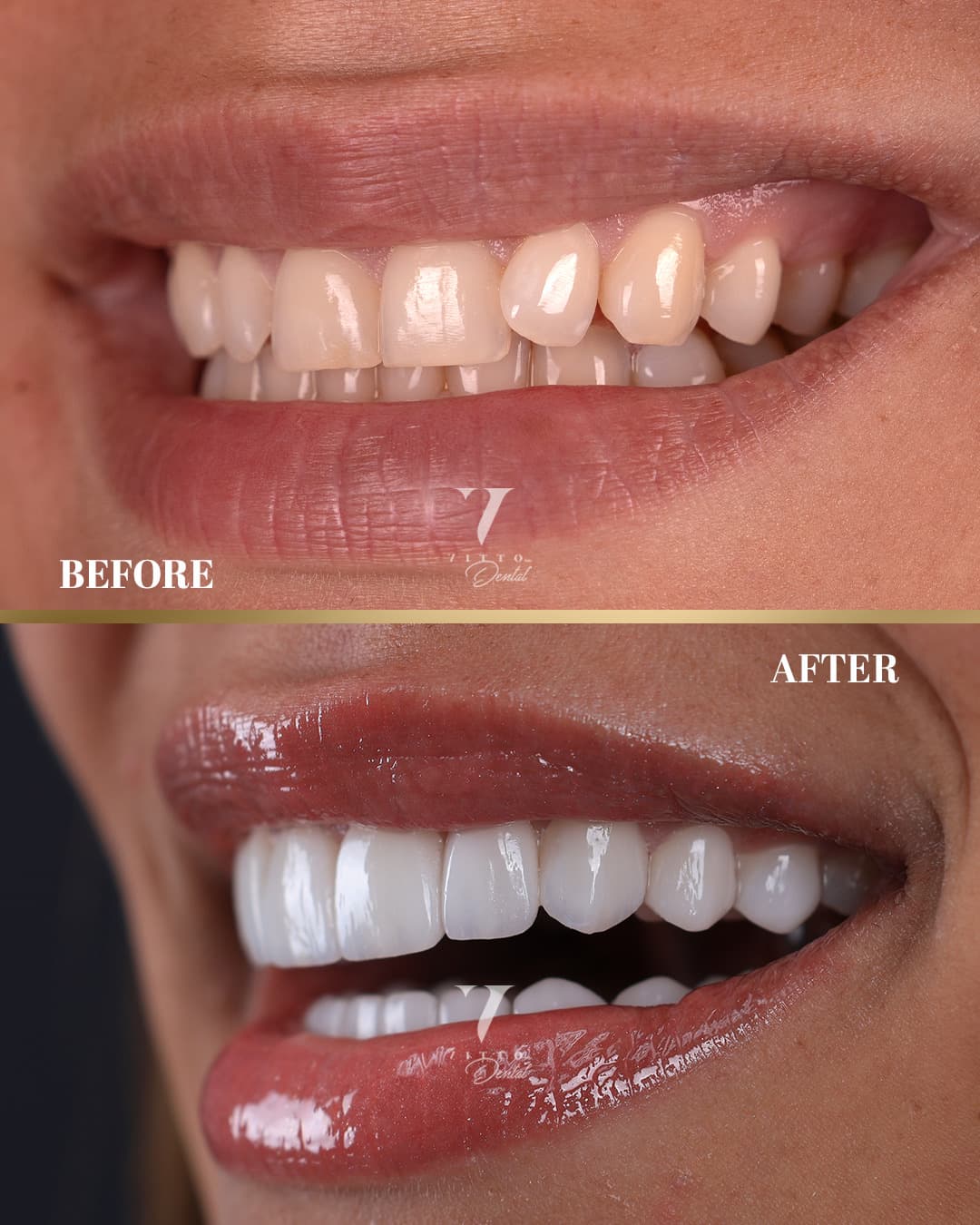 Resultados de Dental - 1
