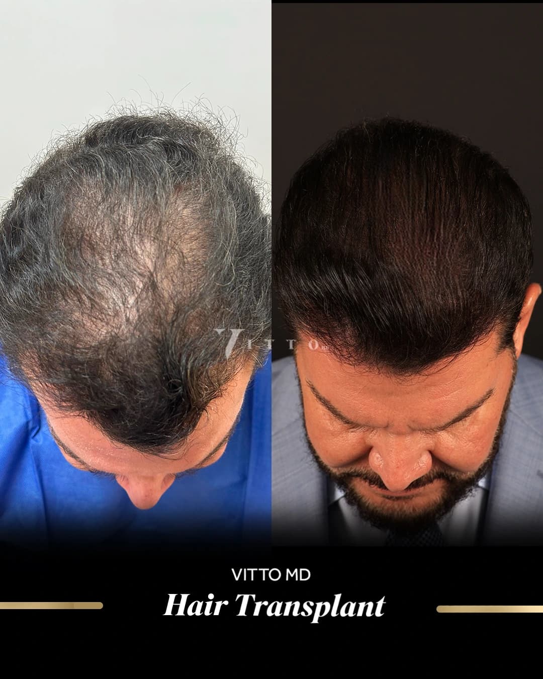 Before & After Results 2