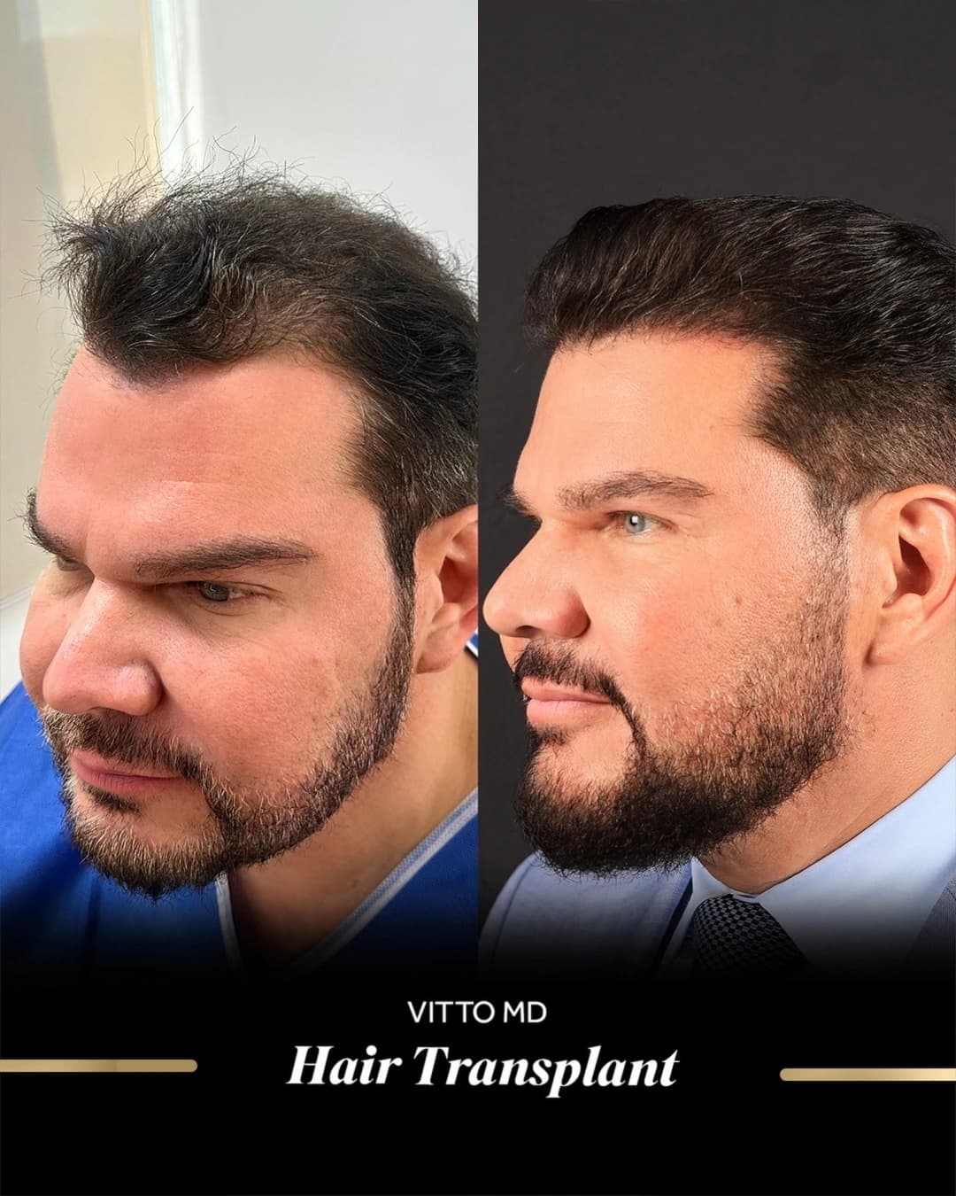 Before & After Results 3