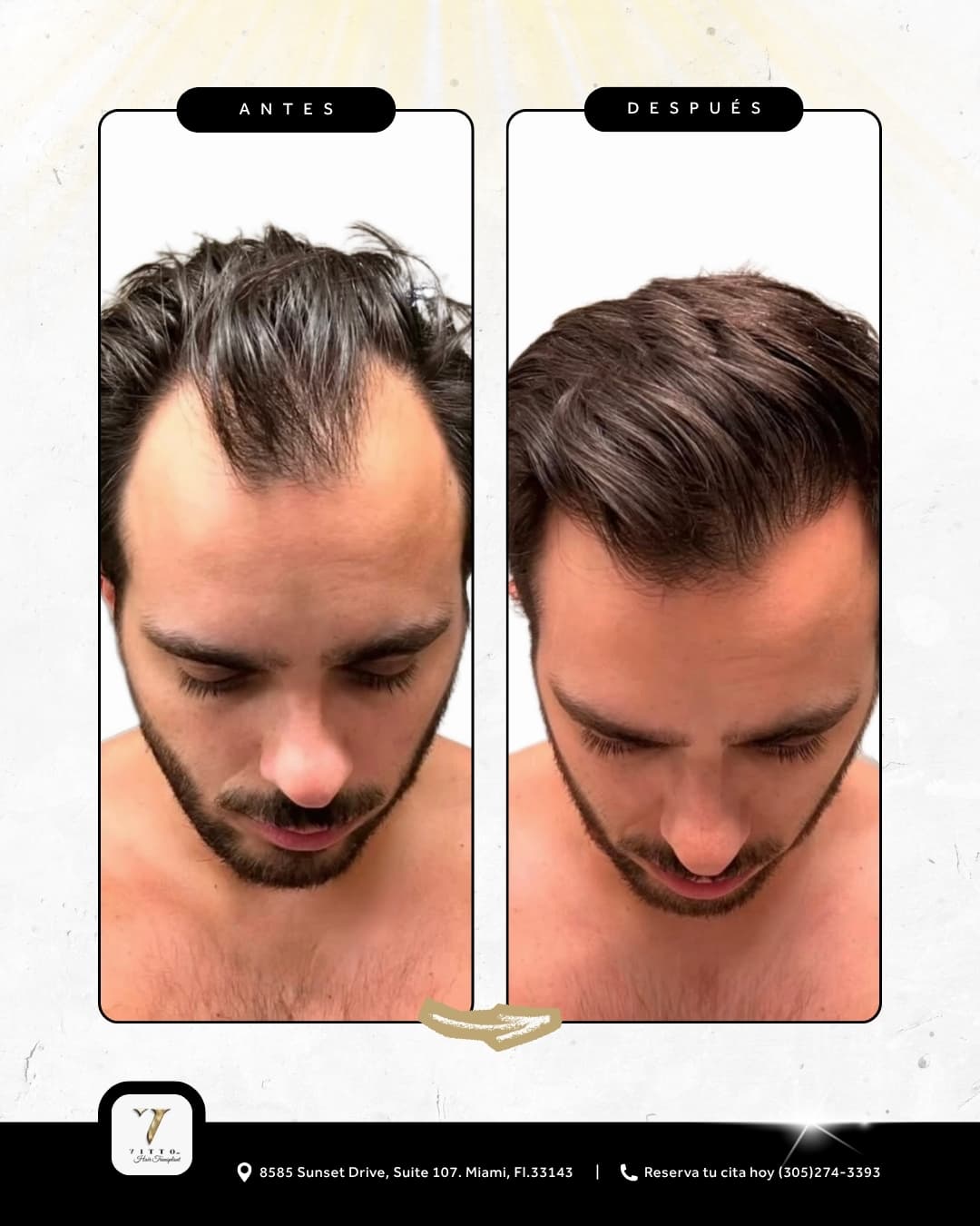 Before & After Results 4