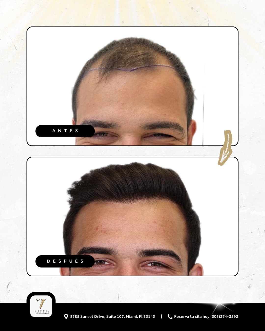 Before & After Results 5