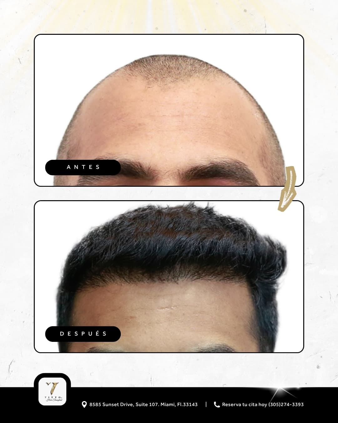 Before & After Results 7