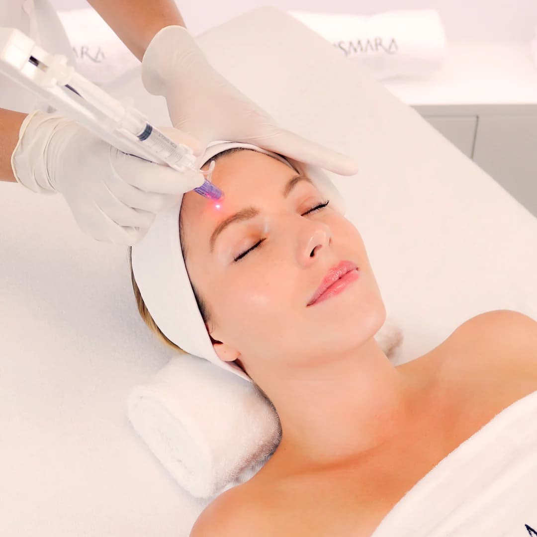 Microneedling