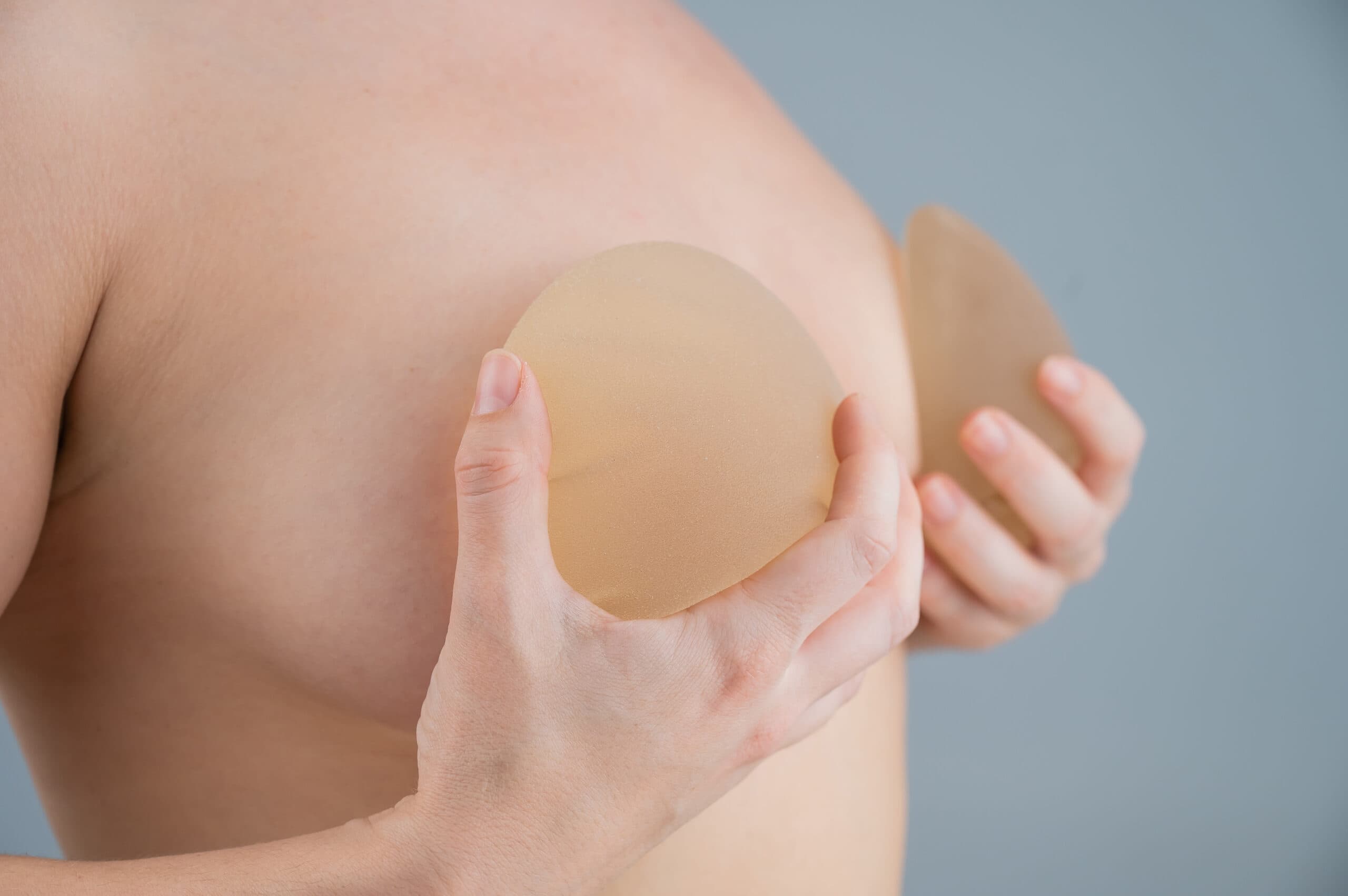 Breast Augmentation at VittoMD - Miami, FL