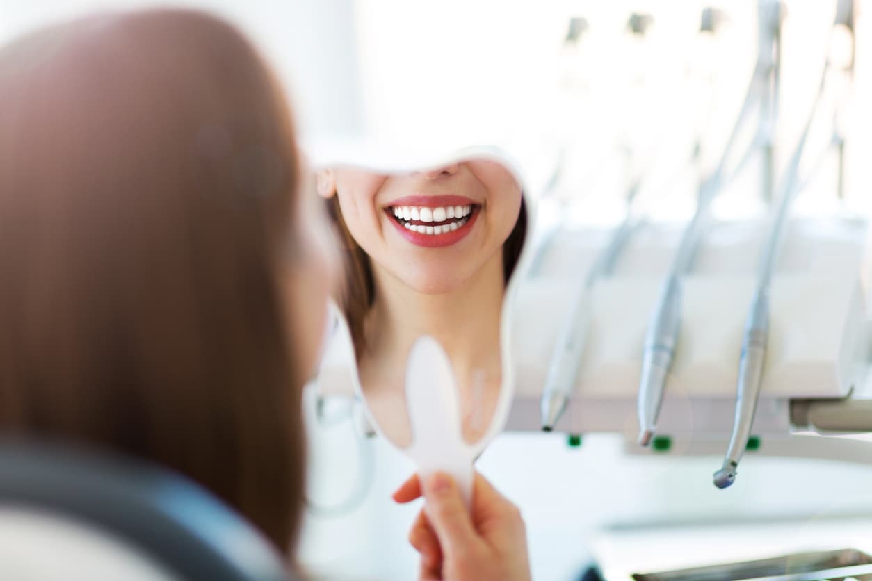 Composite Veneers