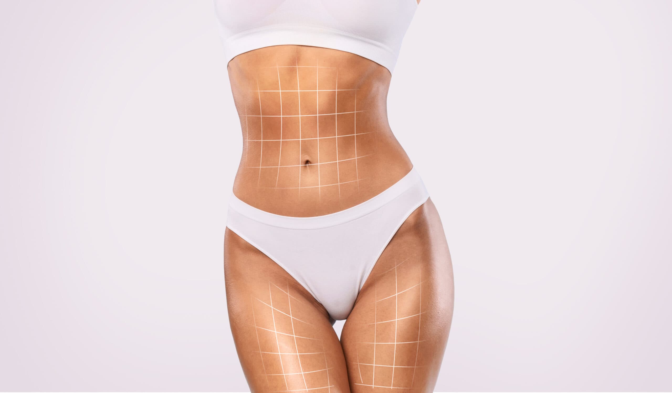 Lipo 360 at VittoMD - Miami, FL