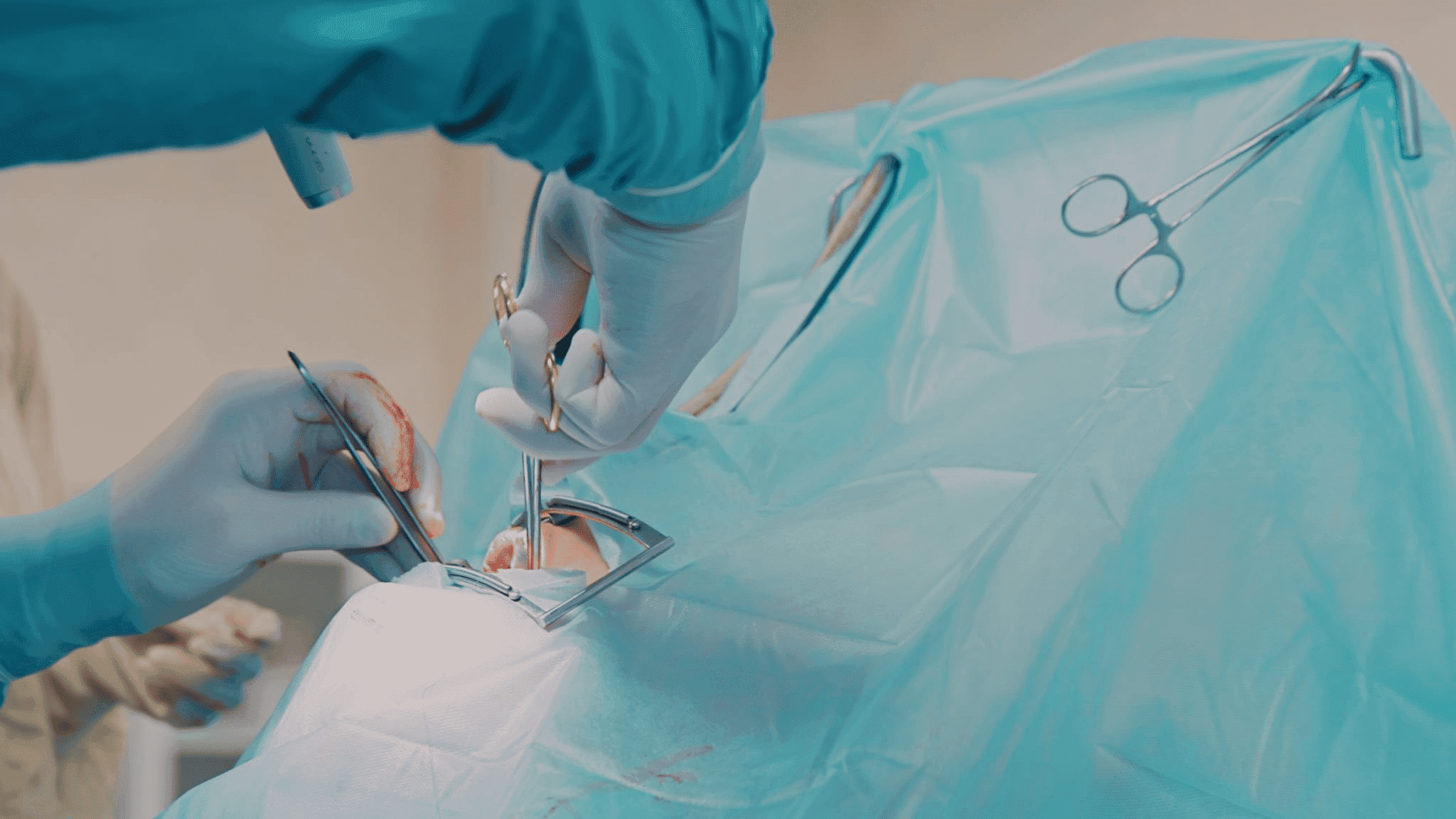 Oral Surgery