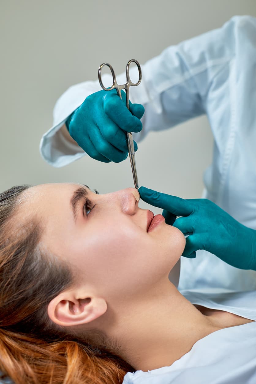 Rhinoplasty at VittoMD - Miami, FL