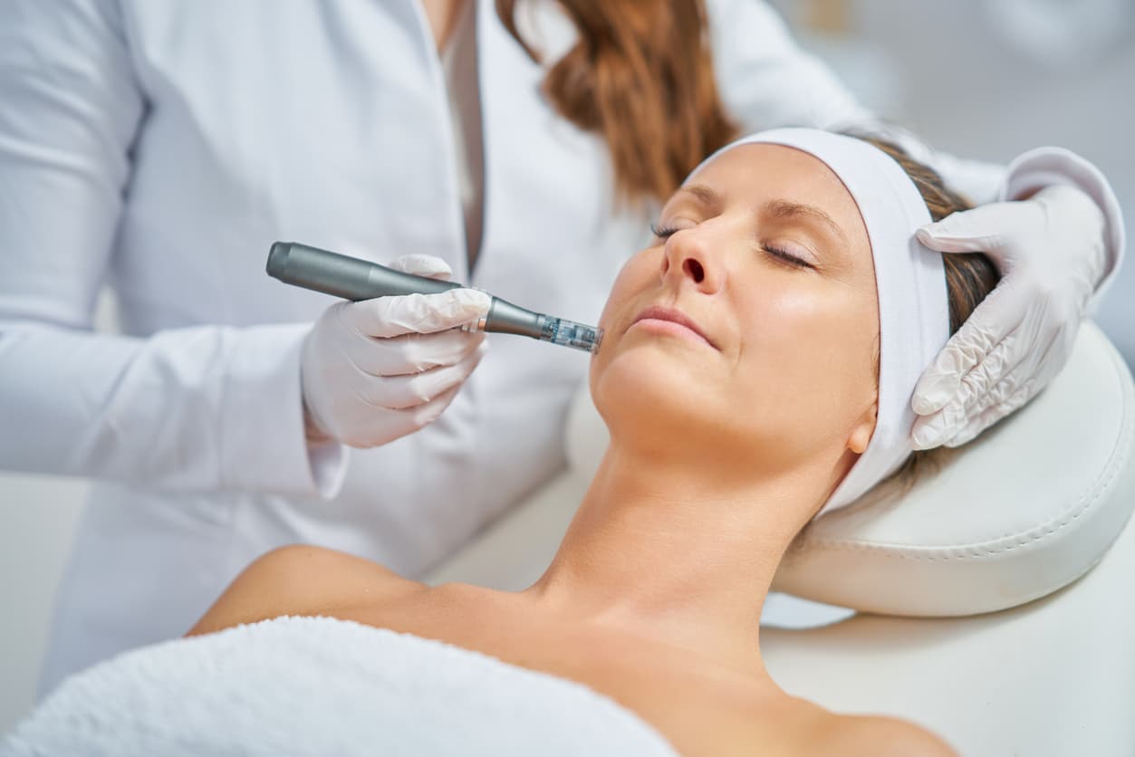 PRP Facial
