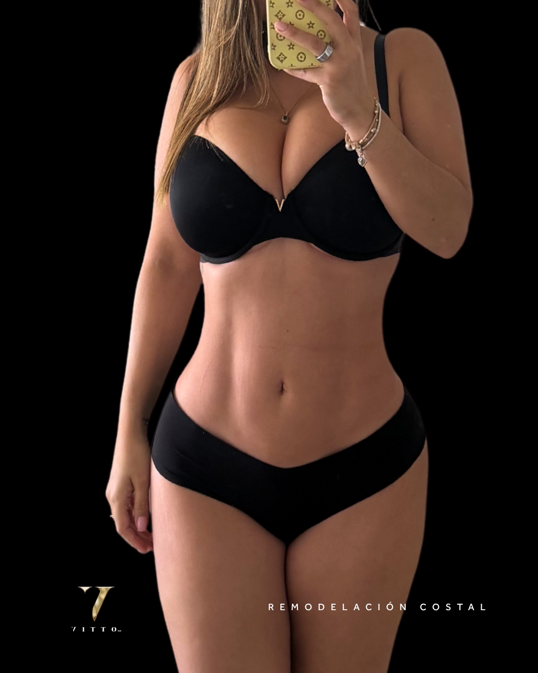 Defined waistline — VittoMD Miami